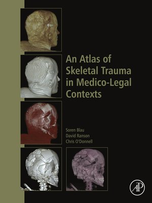 cover image of An Atlas of Skeletal Trauma in Medico-Legal Contexts